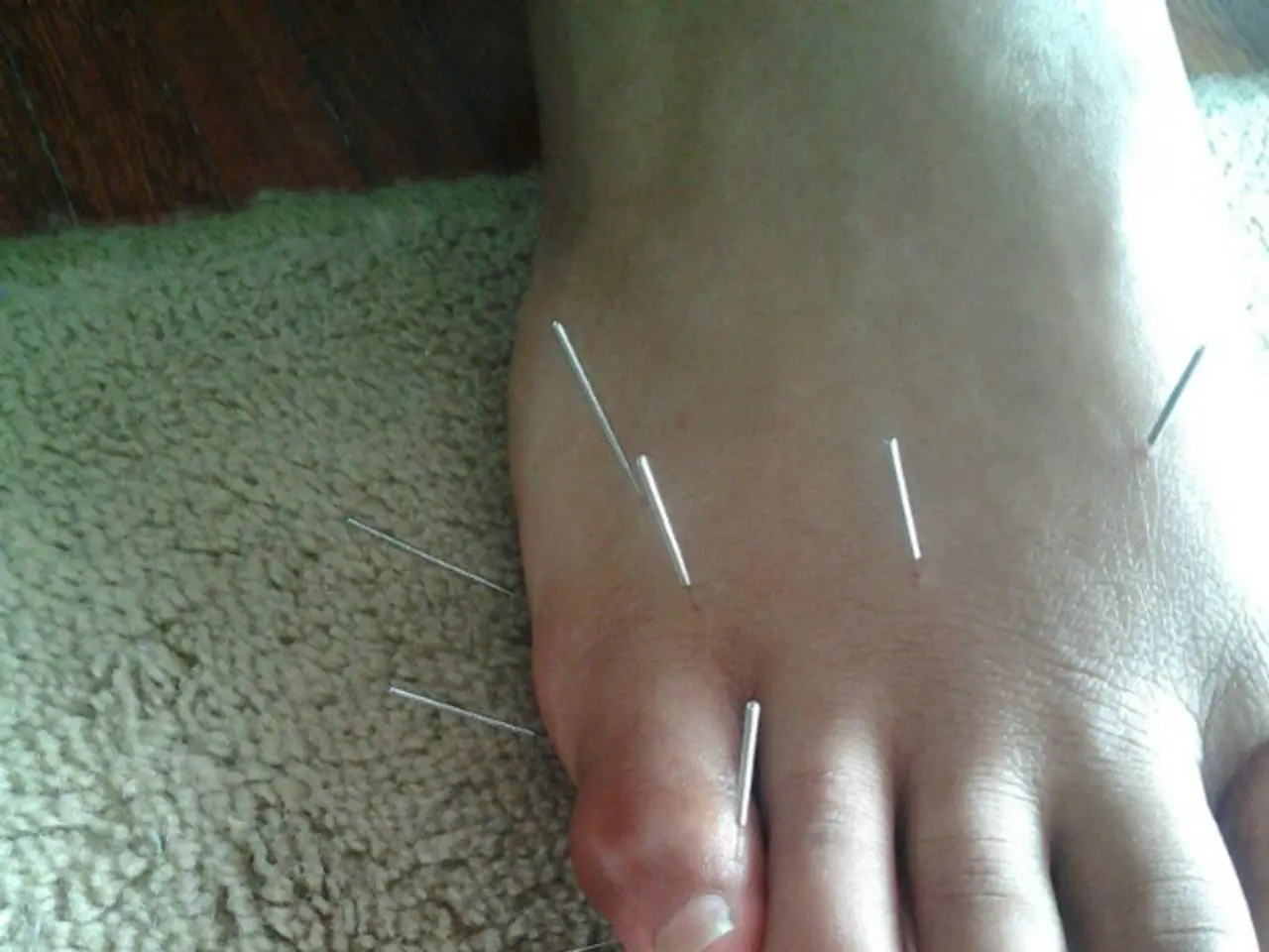 Classifying Appendicitis: The Medical Approach