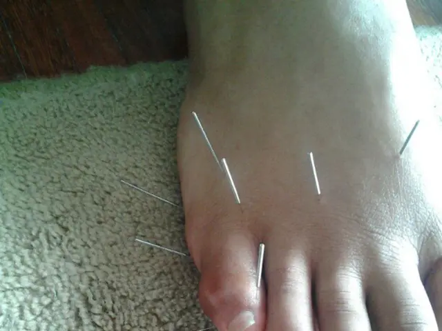 Classifying Appendicitis: The Medical Approach